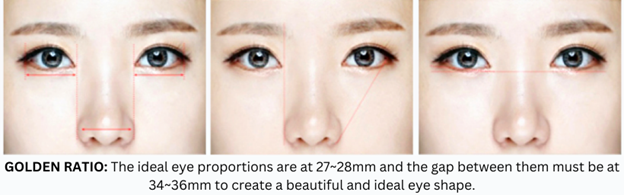 Revision Eye Surgery Revision Eye Surgery